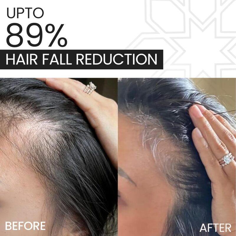 NOVEGROW STEM SERUM 60ML