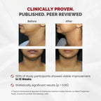 CHOSEN Sculpt Serum Double Chin & Jawline Firming Serum 30ml