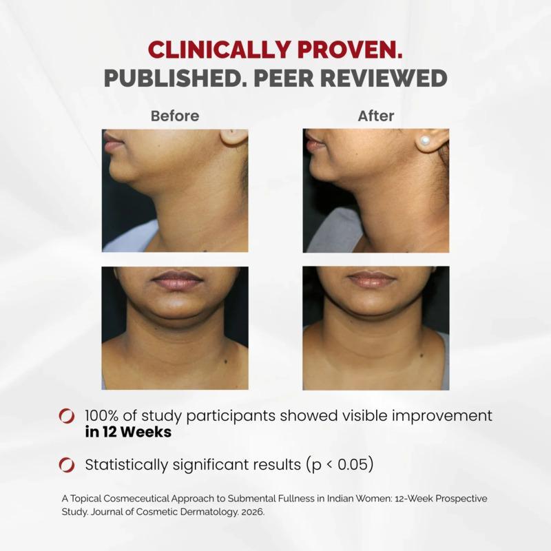 CHOSEN Sculpt Serum Double Chin & Jawline Firming Serum 30ml