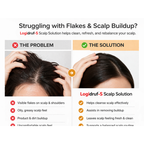Logidruf -S Shampoo with Coal Tar and 2% Salicylic Acid -(100ml)