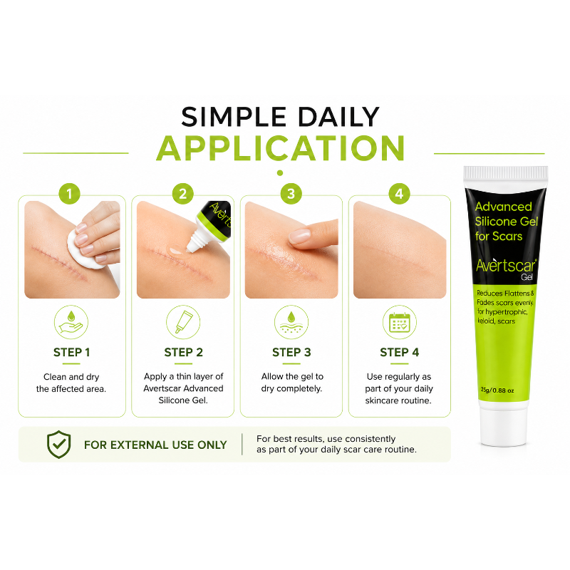 Avertscar Advanced Silicone Gel for Scars (25gm)