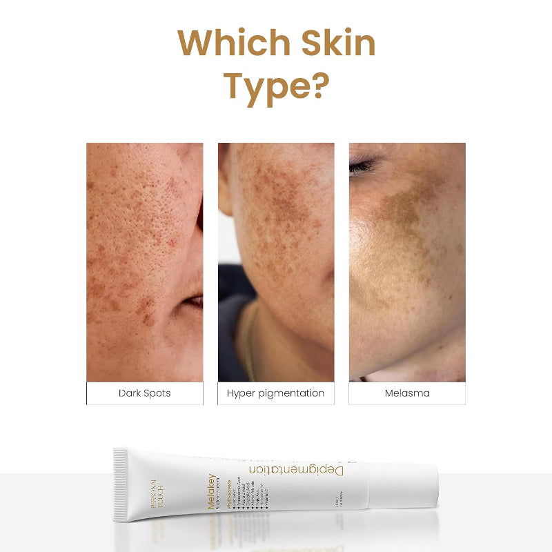 Melakey Radiance Skin Treatment Cream for Pigmentation & Melasma (20gm)