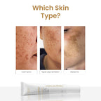 Melakey Radiance Skin Treatment Cream for Pigmentation & Melasma (20gm)